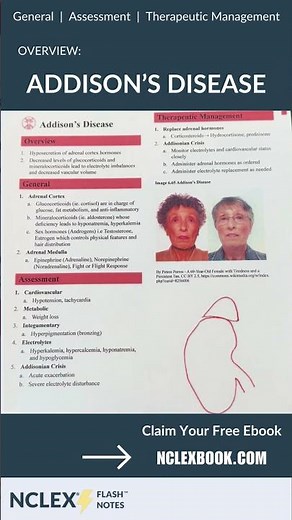 Addison's Disease Overview for Nursing Students #shorts #NCLEX #nursingschool #nursing #nclexprep