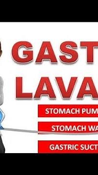 Gastric Lavage full procedure
