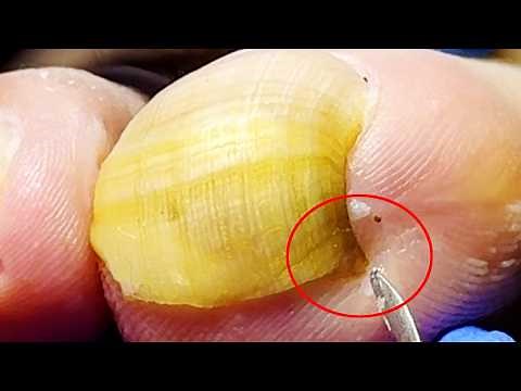 Wow~ This Toenails Are A Bit Cute, Trim It Carefully【Xue Yidao】