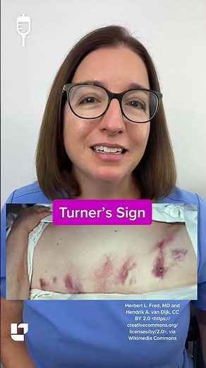 Cathy Explains - Turner’s sign: Medical Surgical SHORT | ‪@LevelUpRN‬