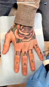 80 reactions | How Laser Tattoo Removal Works?  | Full Process Explained || #LaserTattooRemoval #TattooRemoval #SkinCare #MedicalReels #aestheticclinic | Universefactsai | Facebook