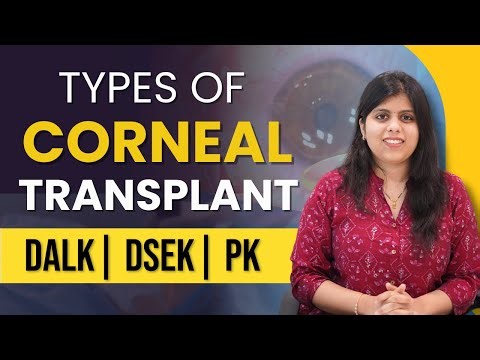 Types of Corneal Transplant: DALK vs DSEK vs PK Explained