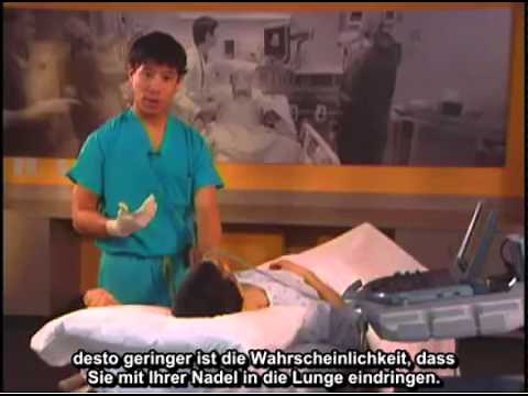 Anleitung: Ultraschallgeführte infraklavikuläre Nervenblockade des Plexus brachialis