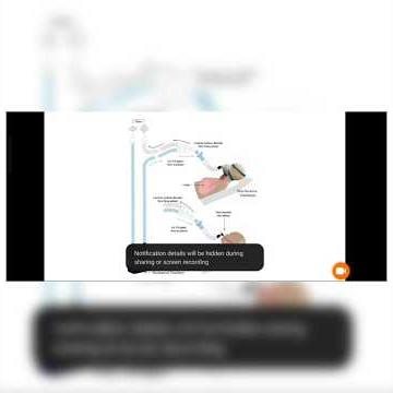 Non invasive mechanical ventilation #cpap #bipap #hypoxamia #hypercapnic #IPAP#EPAP#fypシ #fypviralシ