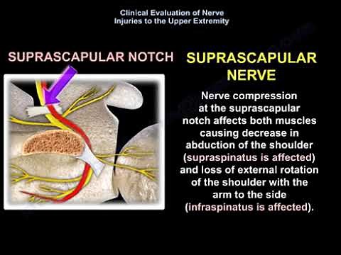 The Rotator Cuff Nerve: Suprascapular Nerve Causes, Symptoms, and Treatment