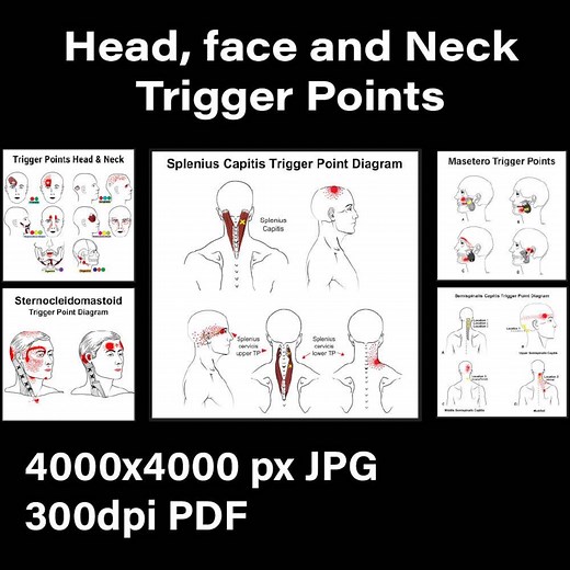 Head & Neck Trigger Point Charts: Muscle Pain Relief Diagrams (PDF) - Etsy