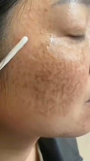 28K views · 43 reactions | The Best Natural Face & Skin Scrub ✨ Say goodbye to dull skin with this all-natural scrub!  Perfect for exfoliating, rejuvenating, and giving your face that healthy glow. Made with simple ingredients you can find at home. #SkincareRoutine #NaturalGlow #DIYBeauty | Natural Recipes | Facebook