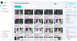Pixel Perfect: V7 Labs Automates Image Annotation for Deep Learning Models