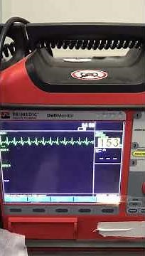 What's #Branham's sign - from Dr Dayaram #medicine #cardiology