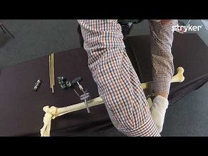 Hoffmann 3 External Fixation System: How to build a Knee Bridging Frame with Prof. Seligson