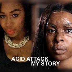 14M views · 1.3K reactions | In 2012, Naomi was the victim of an acid attack carried out by one of her oldest friends. | BBC Three | Facebook