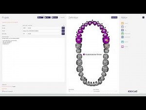 So geht's! Basiswissen für Einsteiger in exocad™: Einstieg im Projekt- oder Auftragsblatt