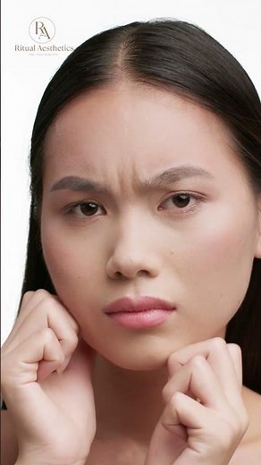 Botox Explained: Real Results, Benefits, Myths & What to Expect