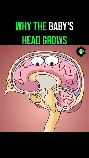Healthrivex | Daily Health Tips on Instagram: "Ever seen a baby with an unusually large head? This animation explains a condition called hydrocephalus, or "water on the brain". Our brains are surrounded by cerebrospinal fluid, which cushions and protects them. Normally, this fluid flows freely, but sometimes a blockage occurs, trapping the fluid inside the skull. As the fluid builds up with nowhere to go, it causes the brain to swell and the head to expand. The doctor explains that surgery is ne