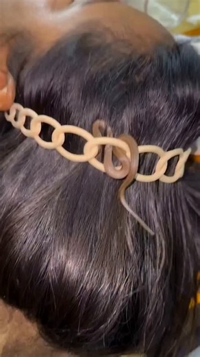 gharelu tips 07 on Instagram: "सर दर्द का अचूक उपाय.. फॉलो करें @gharelutips07 फॉलो करें @gharelutips07 फॉलो करें @gharelutips07 Pic is used only for educational purpose | Credit Respected Owner ----------------------------------------------------- ☑️ Credit~ Respected Owner ✅ Pic is used only for educational purpose only ☑️ DM For Credit / Removel ------------------------------------------------------ #tipsandtricks #health #instagramreels #brainhealth #gharegharesankha"