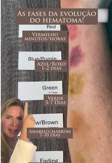Evolução das Cores do Hematoma ao Longo dos Dias