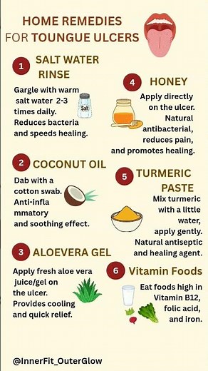Home Remedies for Mouth Ulcers #ulcers #healthylifestyle #shorts