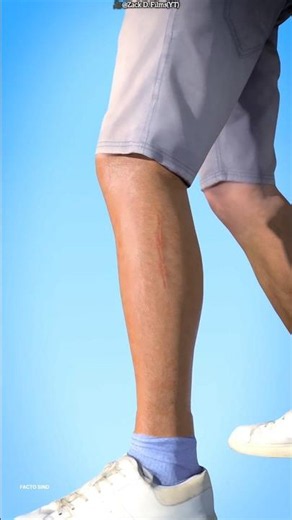 What Doctors Do When Your Leg Gets Cut 😳#shorts #medicalfacts #3danimation