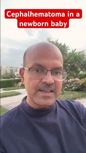 Cephalhematoma in a newborn baby