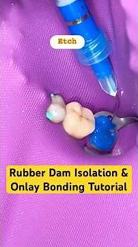Rubber Dam Placement + Onlay Cementation Step-by-Step | Dental Tutorial for Dentists & Students