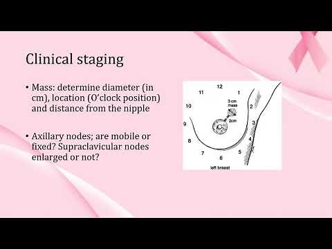 Clinical Presentation, Diagnosis & Staging of Breast Cancer Video