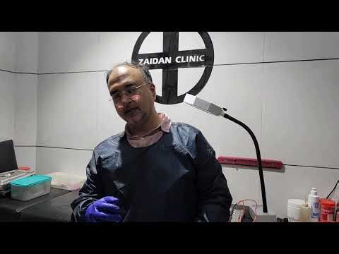 How to apply ointment on ring method circumcision