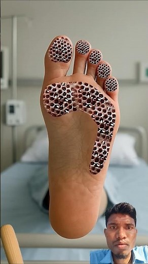 Asmr Deep Foot Treatment And Cleaning Animation #shorts #asmr #animation