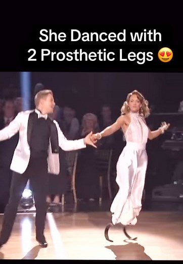 Overcoming Obstacles: Dance with Prosthetic Legs