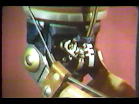 Part 2: Upper Extremity Prostheses Harnessing and Control