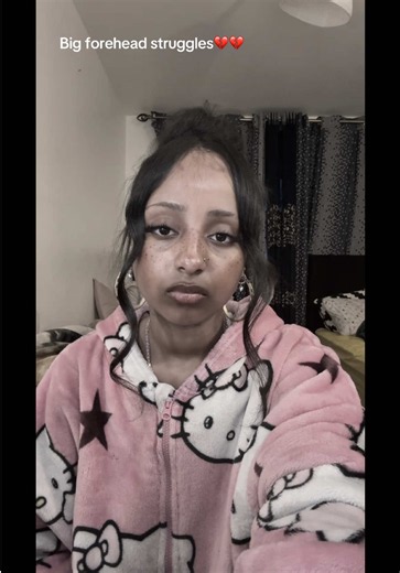 Big Forehead Hacks: Acceptance and Practical Tips