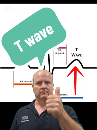 T Wave Basics in ECG Explained