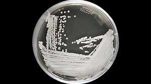 NEW SUPERBUG: The CDC is warning about a dangerous, drug-resistant superbug, a contagious fungus known as “Candida auris” that has sickened nearly 600 people the United States over several years – with some hospitals now using special cleaning chemicals as a precaution. David Muir reports. https://abcn.ws/2D5Sgqt | ABC World News Tonight with David Muir