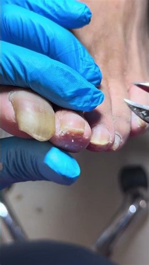 Satisfying Pedicure Video! #pedicure #toenails