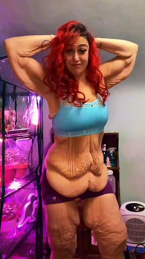 My 240lb weight-loss left me with saggy skin - but I love it 💕 #fbreels #shakemybeauty #excessskin #weightloss #selflove #bodyconfidence #bodypositivity | Shake My Beauty