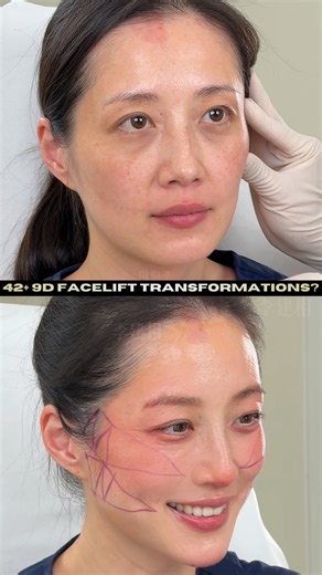 Dr. Liping Xie | 9D Facelift Founder | When was the last time you truly recognized the woman in the mirror? 🪞 We spend our lives taking care of others—our families, our... | Instagram