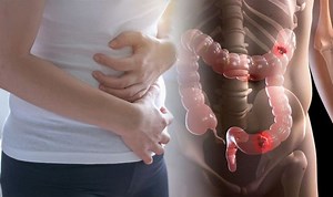 This Morning: Dr Philippa discusses her bowel cancer diagnosis