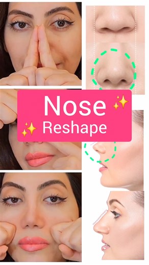 Nose Reshaping Exercises That Actually Work! 👃✨ #shorts