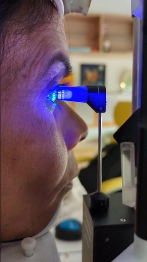 Measuring IOP (Intraocular pressure) using GAT (Goldmann applanation tonometer). #doctor #glaucoma