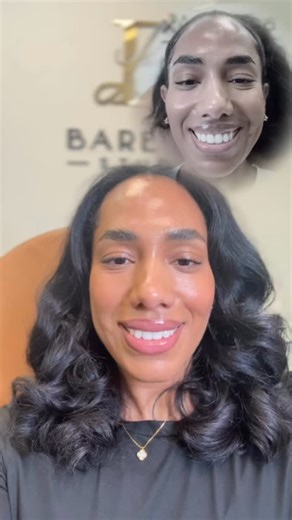 BareLúx Studio | Medical Spa Serving Central Jersey on Instagram: "No filler. Just a flip 💉✨ 10 days later and this lip is LIPPING. Subtle, relaxed, less gum, all the confidence. Dubai-trained technique. Bare Lux results. Book your lip flip 💋 ————- BOOK NOW - Link on BIO 📲+1 (609) 245-6434 💬📞 📧ecrook@bareluxstudio.com 💻bareluxstudio.com 📍Based in Bordentown, NJ Follow ✨Estefany Crook Garcia, MSN ACNPC-AG @nurstef ✨Escarly Crook Garcia, RN, BSN @adoseofcarly All content is shared with pat