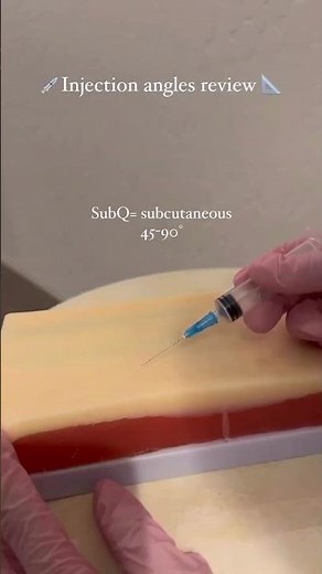 Parenteral Route of Drug Administration | Intramuscular, Intravenous, Subcutaneous , Intradermal
