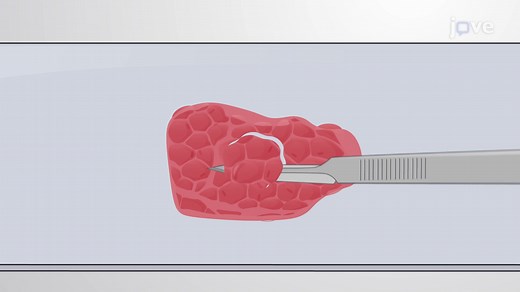 Macrodissection Technique for Cancer Tissue | JoVE EoE