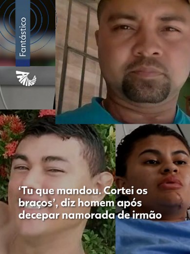 Vítima de tentativa de feminicídio - Após discussão com namorado, Ana Clara teve uma mão decepada e outra quase arrancada pelo cunhado, mas força-tarefa médica em hospital de Fortaleza conseguiu reimplantar membros com sucesso. #g1 #tiktoknotícias #fantástico #mão #Fortaleza #implante