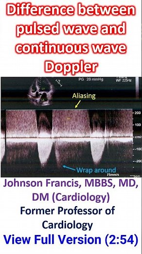 Difference between pulsed wave and continuous wave Doppler