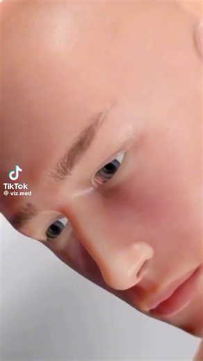 Living with Arteriovenous Malformation for 18 Years