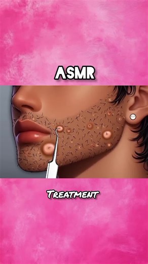Relaxing ASMR Treatment for Stress Relief