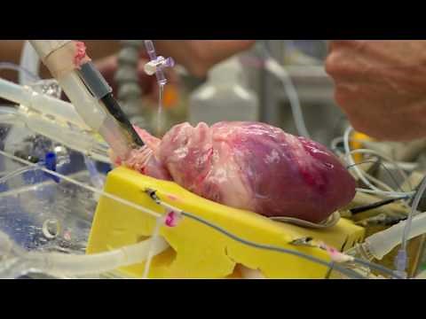 Minnesota lab takes a close-up look at hearts, beat by beat: LiveBIG 2016-17