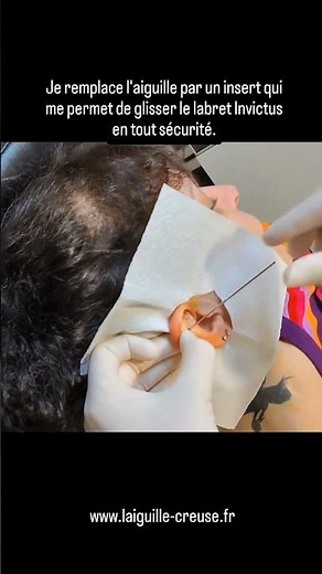 ​👂 Procédure de piercing : Flat