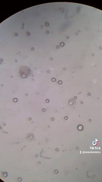 Clean Your Shrimp or Prawns Before Eating – Microbes and Brownian Motion