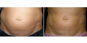 A 30-Minute Session With This Machine Is as Tummy-Toning as 20,000 Sit Ups