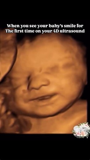 Seeing My Baby Smile for the First Time on 4D Ultrasound 🥹 #baby #shorts #youtubeshorts